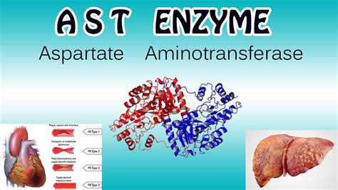 aspartate aminotransférase élève.